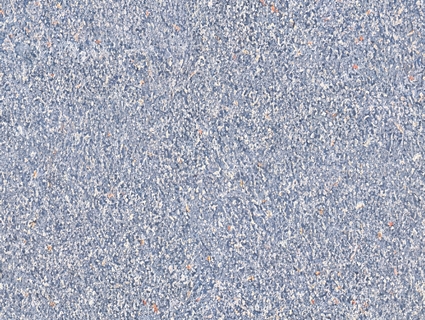 地胶_橡胶地面无缝贴图下载-1